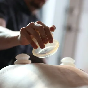 cupping therapy